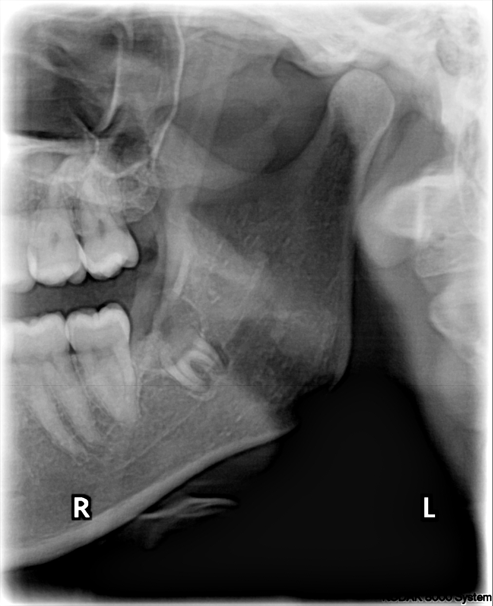 Dental x-ray